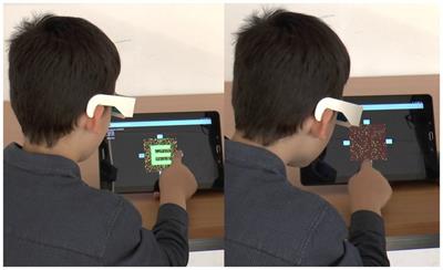 Artificial intelligence-based screening for amblyopia and its risk factors: comparison with four classic stereovision tests